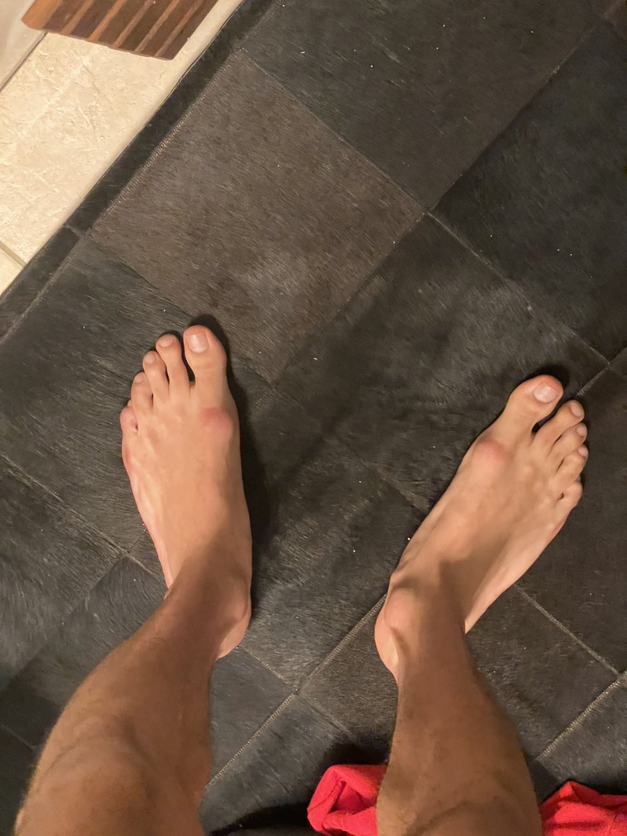 Dressboi's tweet photo. Who got a foot fetish ? #prettytoes https://t.co/re526uj3Uw