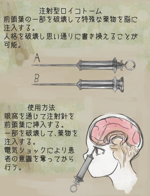 人格を書き換える手術。 