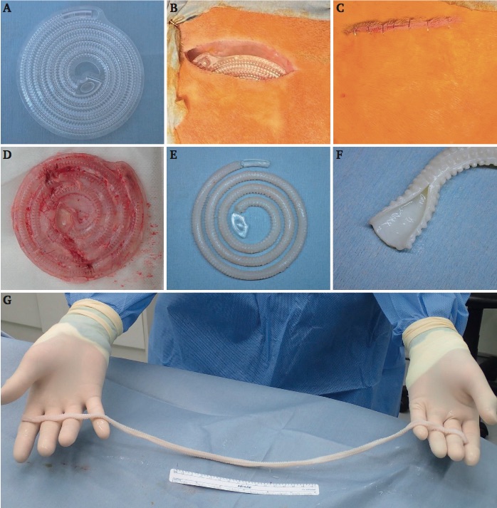 The development of new bypass graft materials is key for our future patients.
Take a look at this "Acute Phase Pilot Evaluation of Small Diameter Long iBTA Induced Vascular Graft “Biotube” in a Goat Model" by R. Hogashita et #openaccess in:
ejvesreports.com/article/S2666-…

#EJVESforum