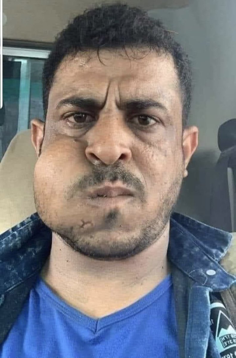 الخيلي
الشوحطي
صامد سناح ابو جنبين
أمام النوبي
حمدي شكري
غسان السعدي 
يقابلهم من الشرعية
انيس منصور
والرحبي
ومهند الرديني
 وبنت الاهدل
كما ينظر الانتقاليين باحتقار ودونيه لتلك الاسماء المخنثة، فهناك جنوبيين يرون قيادات البسط والنهب اعلاه كوارث جنوبيه خائنه ومسيئه للانتقالي