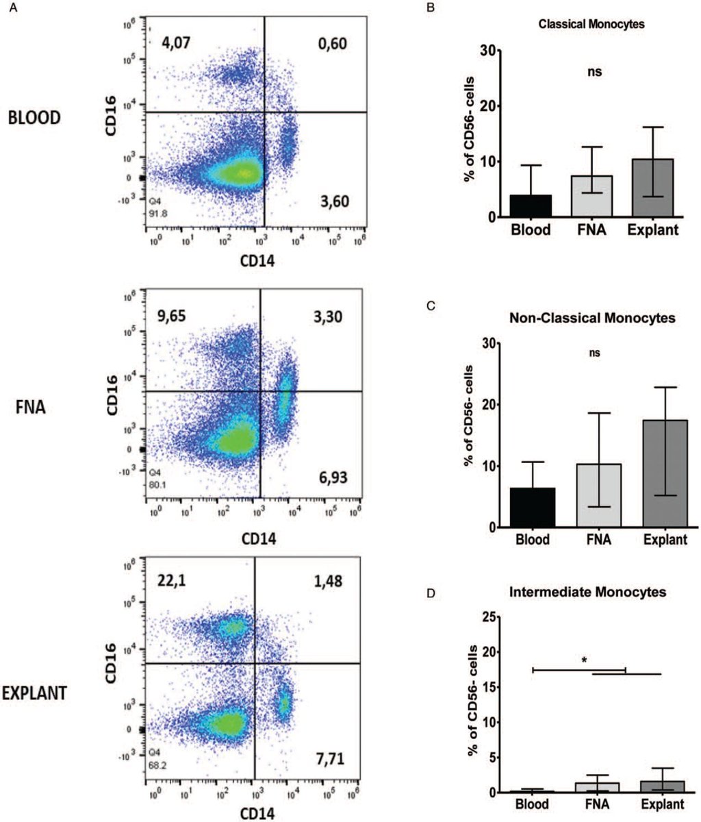 Yuksel (<a href="/DrMuhammedYuks1/">Dr Muhammed Yuksel</a>) et al explored the use of FNA as a less invasive method of sampling hepatic immune cells , including regulatory B and T cells. 

journals.lww.com/jpgn/Fulltext/…