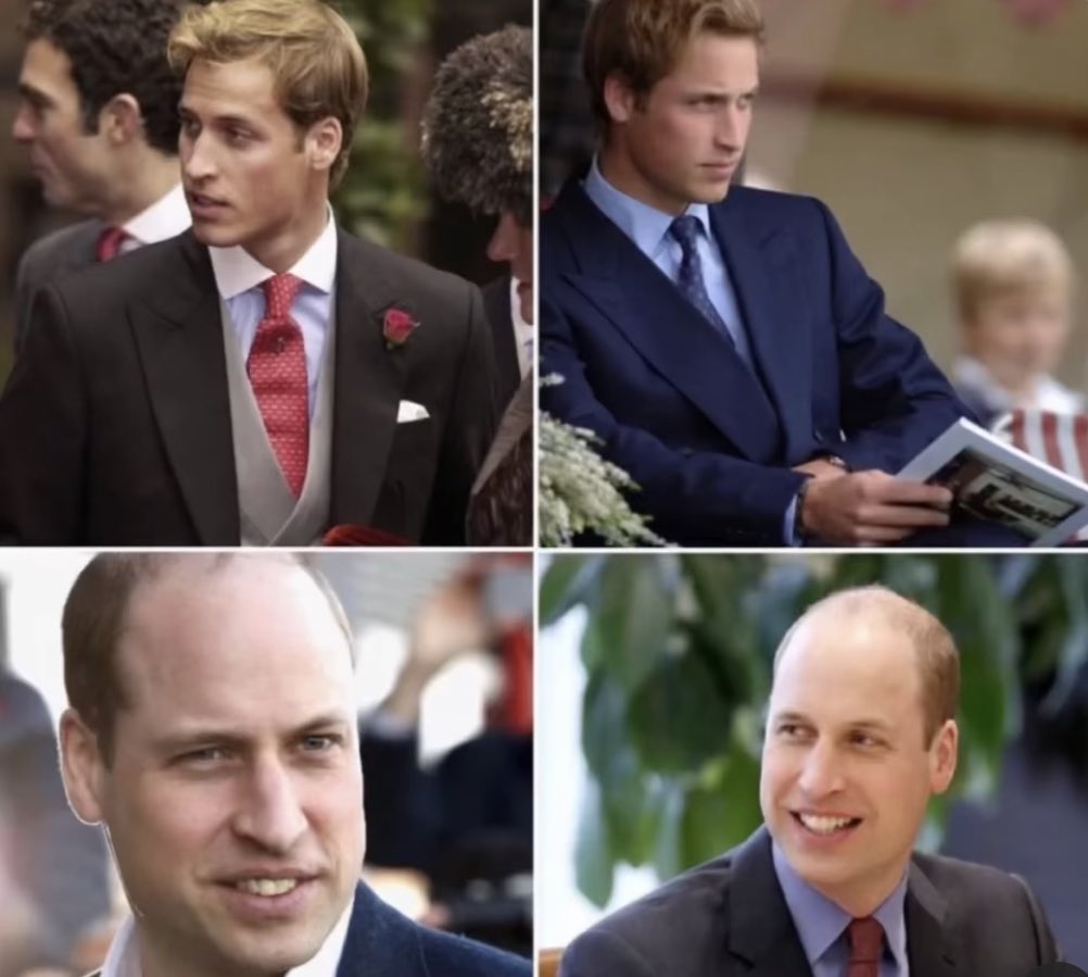 Prince William is aging like a new grad nurse on night shift