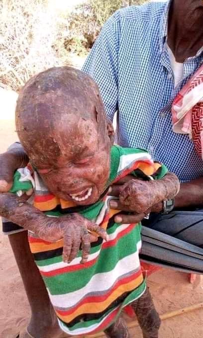 SahissaJr's tweet photo. It seems subordinating human rights to ones own national interest is the order of the day. #TPLFTerroristGroup is waging an all-out war on the people of Afar in #Ethiopia w/ silent approval of those who pretend to care concerning human suffering. SAD
#AfarUnderAttack https://t.co/EDGULlg01C