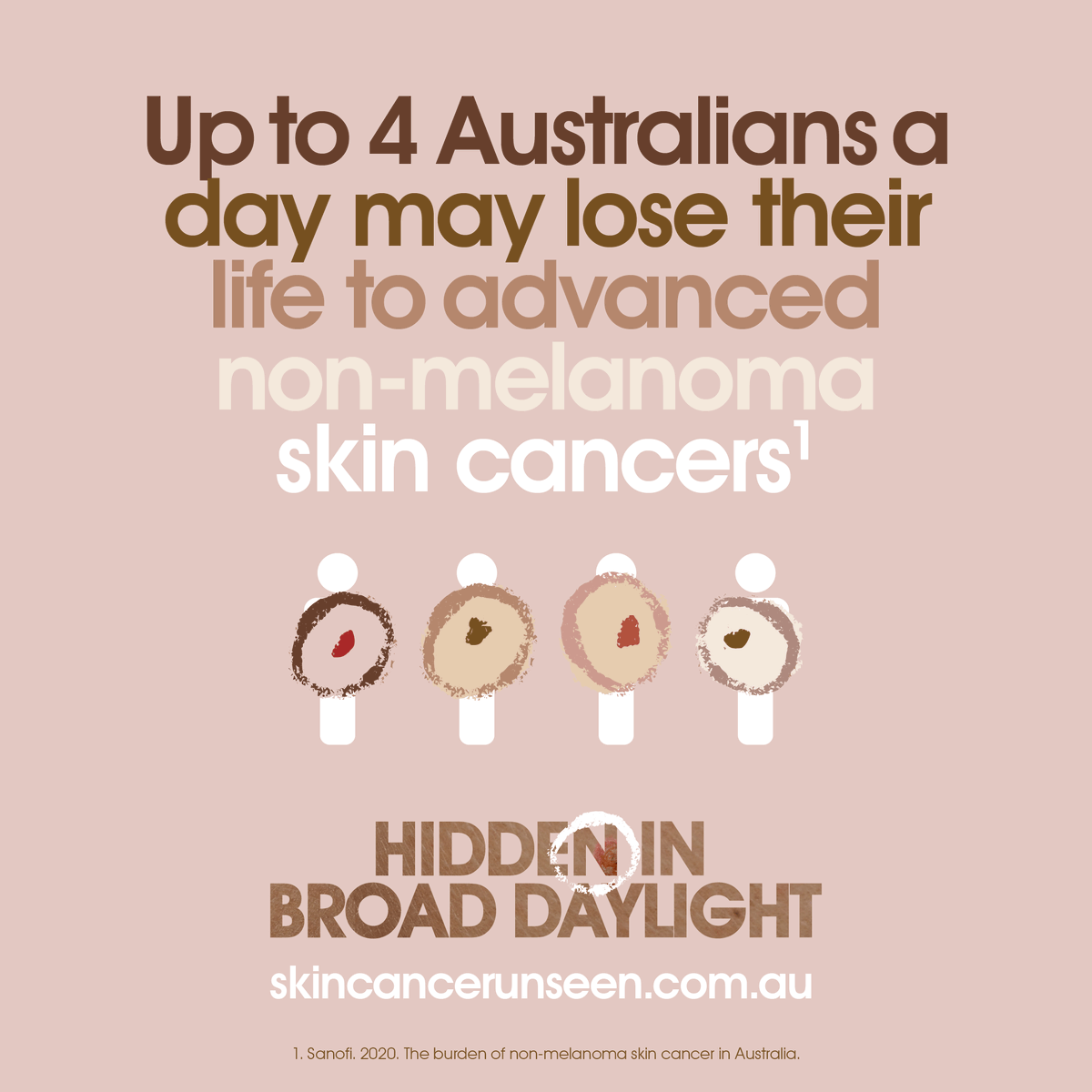 SanofiANZ's tweet photo. Did you know up to 4 Australians may lose their lives to advanced #nonmelanoma #skincancer every day? 

Find out more at https://t.co/gyqXlaSsFH 
#SkinCancerUnseen #HiddenInBroadDaylight #melanoma https://t.co/oslGudwxou