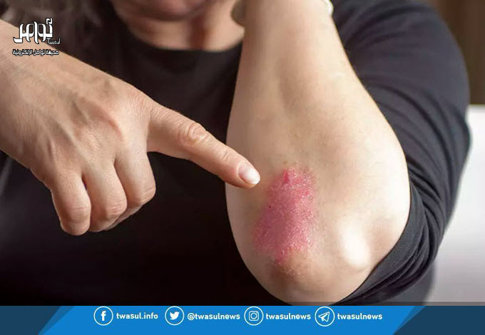 مرض خطير.. ظهور هذه العلامة ينذرك به

twasul.info/1768331

#الصحة #صحتك_حياتك #الجلد #مرض