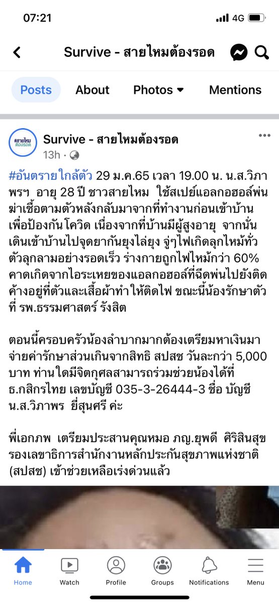 โห อันนี้คือน่ากลัวมาก เขาใช้สเปรย์แอลกอฮอพ่นตามตัวก่อนเข้าบ้านแล้วมาจุดยากันยุง ไฟลุกท่วมตัว แอลกอฮลมันเปนตัวที่ทำให้จุดไฟติดอะ มันอันตรายมาก แล้วก็น่าจะมีหลายคนเลยไหมที่ทำแบบนี้ ระวังกันด้วยนะ 😰😰