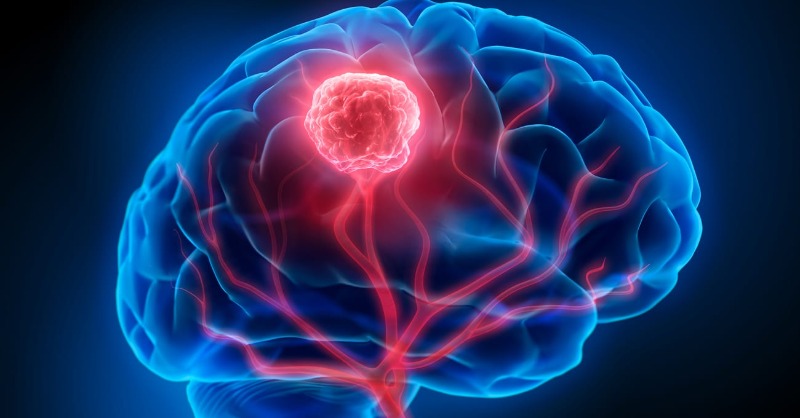 HopkinsMedicine's tweet photo. Research by @HopkinsNsurg could offer a new way to fight a lethal type of brain tumor.