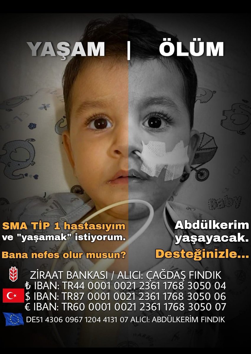 Abdussma's tweet photo. ‼️KAYBEDİYORUZ ‼️
Son 900 gram 
Evladimiz yutkunma kaslarini kaybettigi icin artik midesine acilan peg yöntemiyle besleniyor😞 Daha fazla kayba uğramasın
Abdülkerim YAŞASIN
 
Karda #dolar #SurvivorAllStar2022 #Açık15BinleKapatılmaz Yalan Betül Gomis #Ankaraemniyetiskence #ZAMpül https://t.co/iF3bwL1RA1
