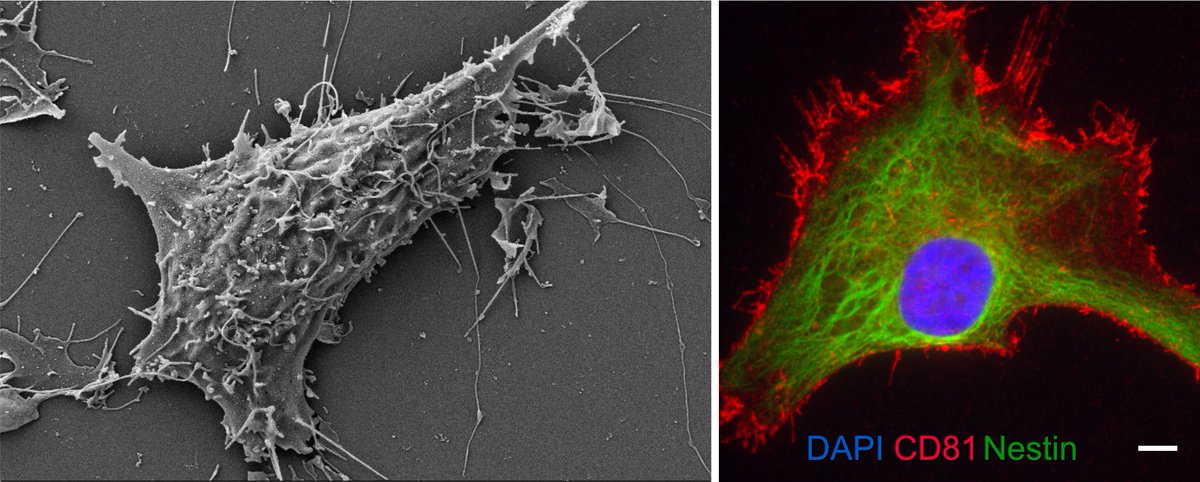 Congratulations #kitz_hd and @DKFZ researcher Kendra Maaß from @Pajtler_Lab on receiving the 2022 CERN Robert Connor Dawes Scientific Fellowship Award from @NBTStweets @CERNFoundation @_RCDFoundation for her work on childhood #ependymoma! bit.ly/3Azra7L