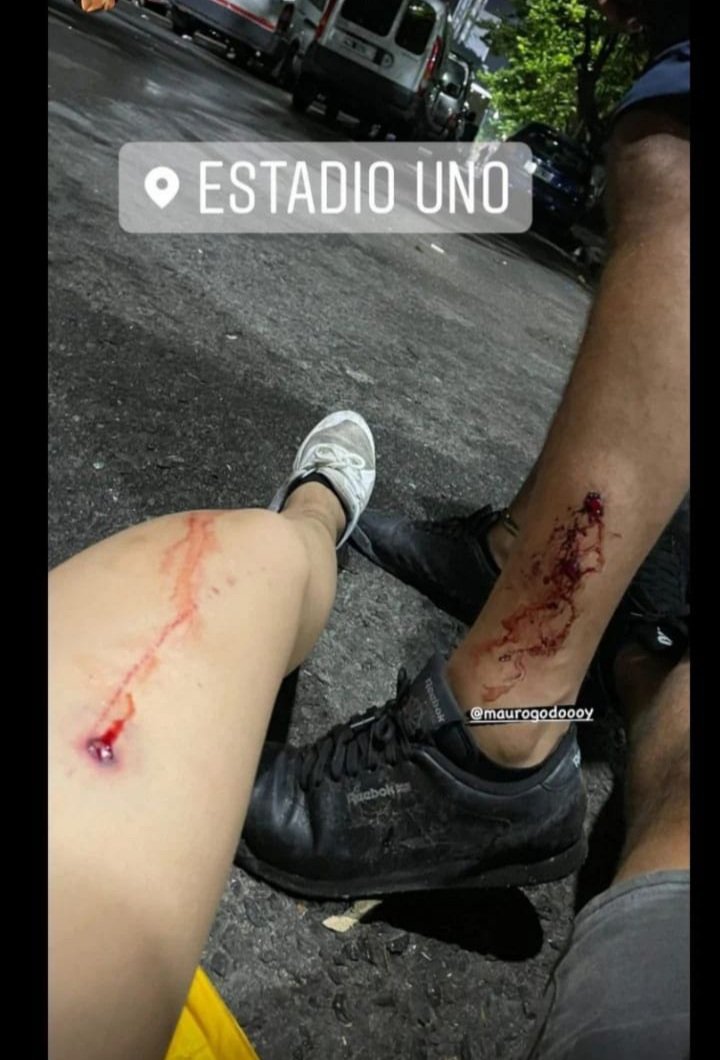 Nicoambrogi's tweet photo. Hola buen día. Nada más para preguntar si ya algun medio de los llamados "importantes" habló del calvario que vivió con la policía el hincha genuino de Boca (y con entrada) afuera del estadio de Estudiantes. No? Ah bueno. Soretes. https://t.co/eZeJIQBEnw