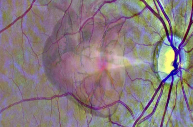 Cn1699's tweet image. Using the eye as a window into heart disease

#eyescan #heartdisease #AI

For more information | ⬇️
buff.ly/3H6CKcU