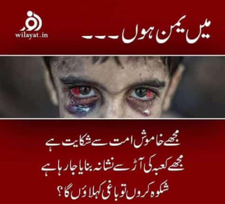 shabbr_naqvi's tweet photo. Yemen is bleeding 😢😢

#Yemen 
#YemenUnderAttack 
#yemenisbleeding 
#SaveYemen 
#SaudiwaronYemen https://t.co/13lhfEUoeh