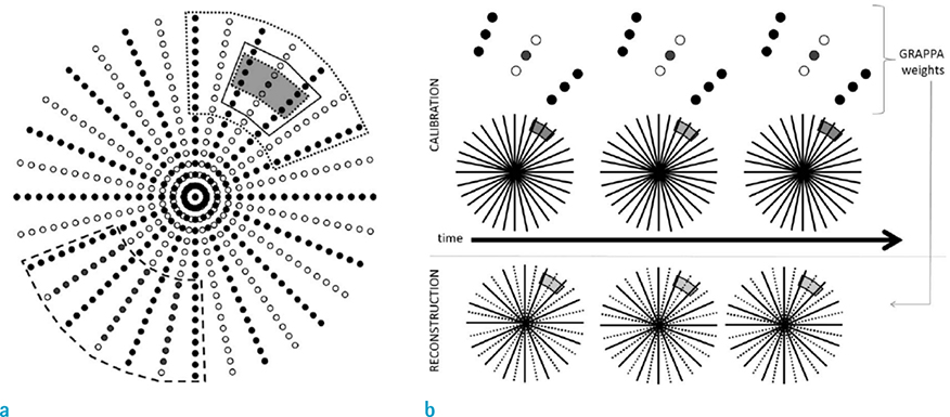 2021 DEC 25(4) - 4. Review Article

'Fast Real-Time Cardiac MRI: a Review of Current Techniques and Future Directions'
by Xiaoqing Wang, ...

Full text: doi.org/10.13104/imri.…