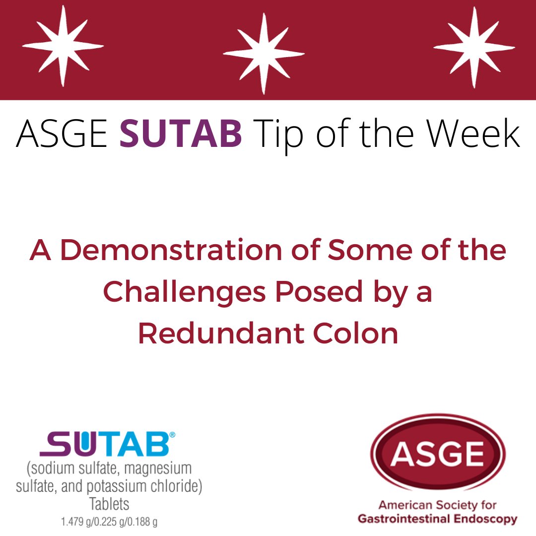 ASGEendoscopy's tweet photo. NEW #SUTAB Tip of the Week! #ASGE President @Rex_colonoscopy demonstrates some of the challenges posed by a redundant colon. Enjoy the full library of short colonoscopy resources! https://t.co/VHardiqHic #Endoscopy #Colonoscopy #CRC #GITwitter #GeneralEndoscopy #AdvancedEndoscopy https://t.co/GnJ6CXiuIP