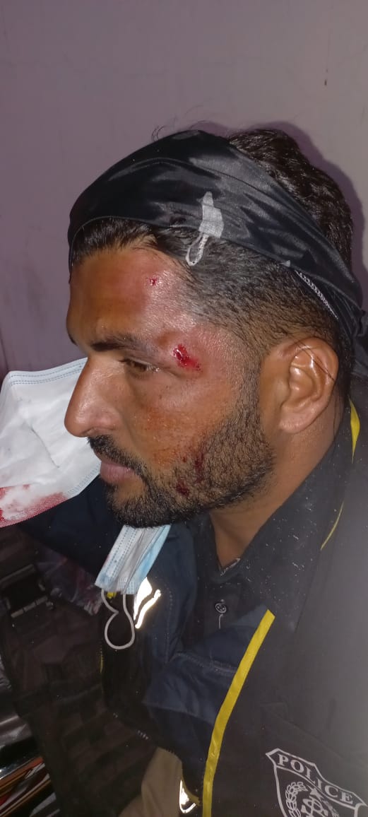 Samarjournalist's tweet photo. One Police Constable (PC-3368) Muzaffar Hussain s/o Muhammad Sadiq age 27yrs, Injured by Sticks/Stones by protestors, while injured shifted to JPMC for medical treatment & further investigation is continues.
PS CIVIL LINE https://t.co/NZV5Z9kkLE
