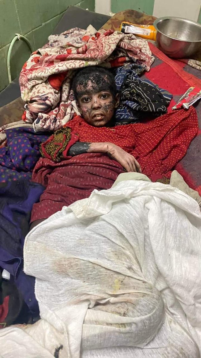 NurTahir3's tweet image. Due to #TPLF invasion #Afar civilians,women,children and elders were injured and killed and hundreds of thousands displaced and are in critical humanitarian condition.
@UN @WFP @antonioguterres
@WFP_Ethiopia @UNICEF