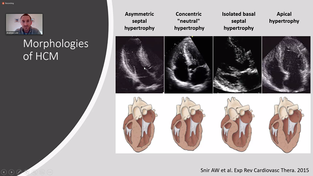 University of Maryland Cardiology tweet media