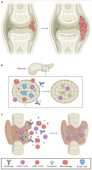 NatRevClinOncol's tweet photo. New Review by Douglas Johnson, Caroline Nebhan, Javid Moslehi (@CardioOncology) &amp; Justin Balko now live online: 'Immune-checkpoint inhibitors: long-term implications of toxicity' 
https://t.co/7ymExYiqEY #ImmunoOnc #medonc https://t.co/m6m92mZwOZ