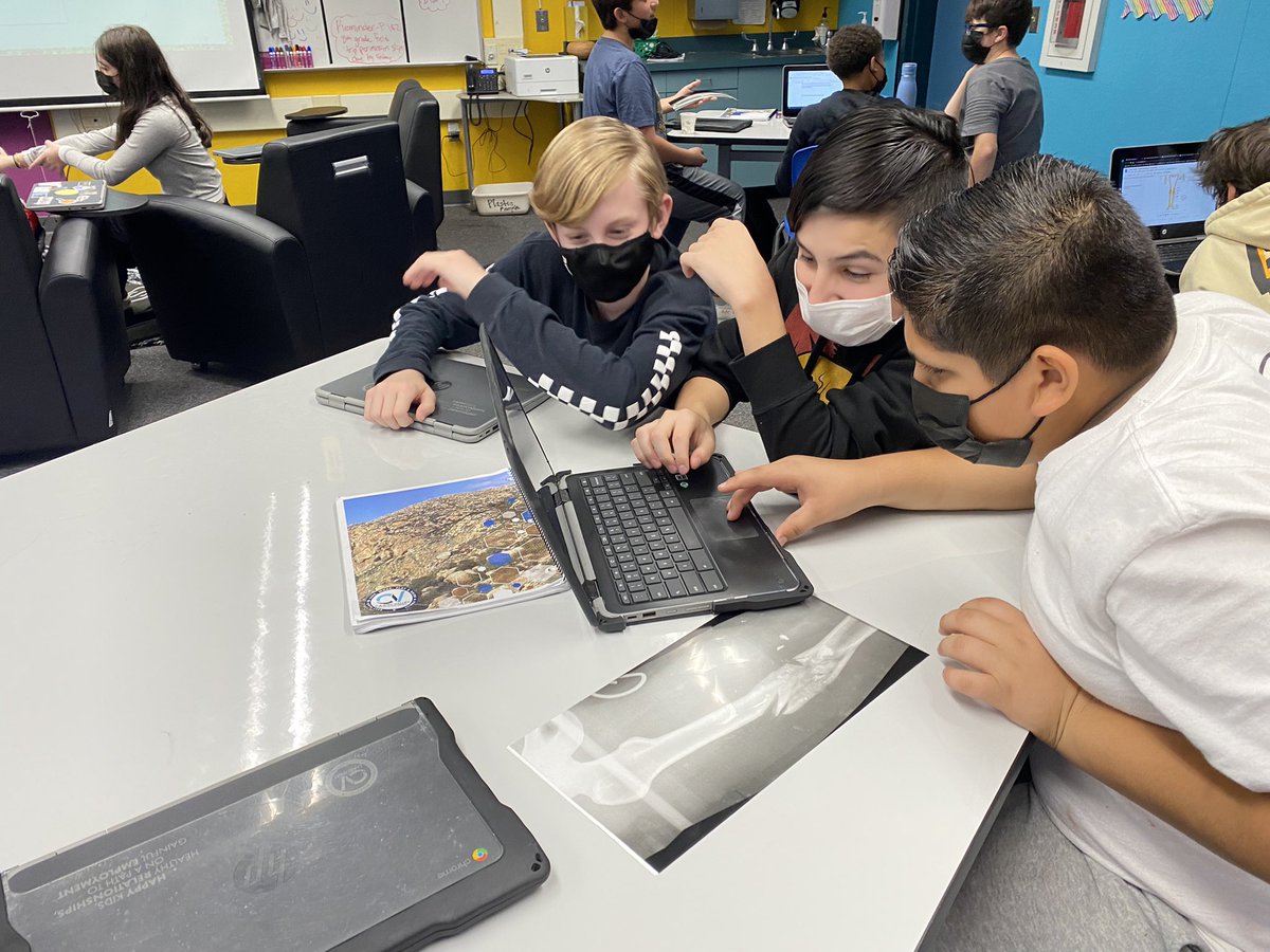 _Emily_Conner_'s tweet photo. Career Simulation Investigative and Artistic-Hillsdale Career Explorations students acted as orthopedic specialists to analyze X-rays of broken bones, determine a treatment plan and write a fictional story about how the injury occurred. @CVWorldofWork @hillsdalepride https://t.co/OXkvhvNSPl