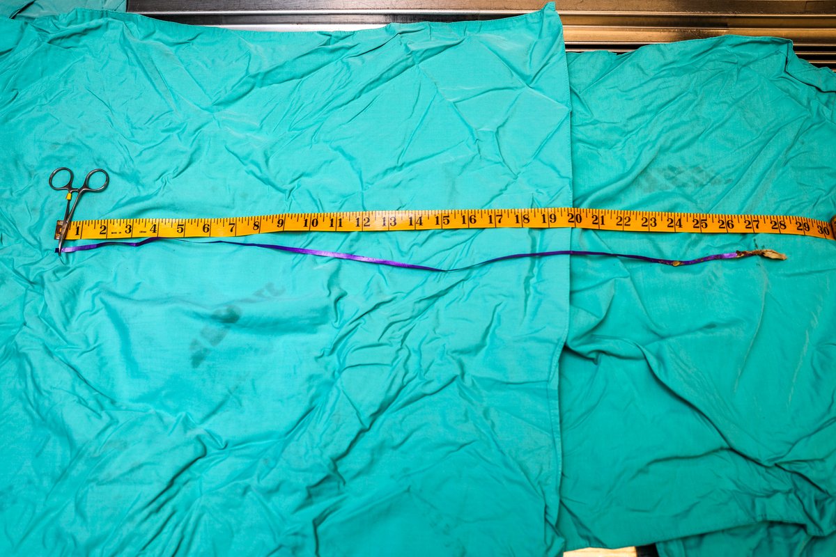 NEAQ's tweet photo. After a particularly complicated surgery, our Animal Care + Rescue &amp; Rehab teams have successfully saved an endangered #SeaTurtle after it ingested a #balloon ribbon!

The turtle will be released back into the ocean over the summer.

Full story: https://t.co/bWSgHXSsFj https://t.co/yx8zc0bCdq