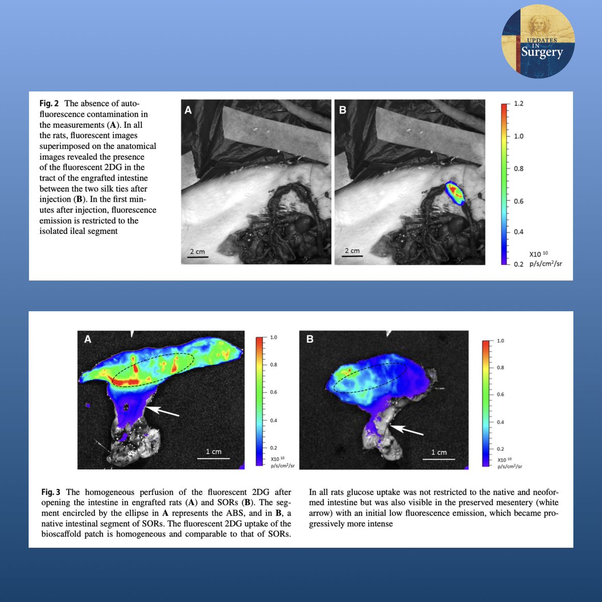 UpdatesSurgery's tweet photo. "This study aimed to evaluate the glucose absorptive capacity of a neoformed intestine obtained from a biological scaffold in a rodent model and the steadiness of the engrafted segment area"

Full article at https://t.co/nQq6CnLSSs

@Totuccio1983 @SalviaRobi @Giampaolo_Perri https://t.co/499vqkQjsH
