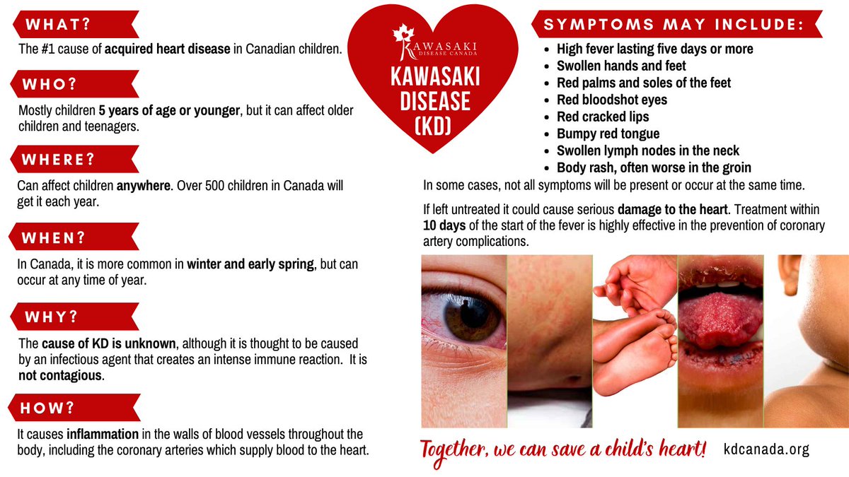 Still time to be part of Kawasaki Disease Awareness Day 2022!  We want every parent and every caregiver across Canada to know about it. Kawasaki disease is the #1 cause of acquired heart disease in Canadian children. EARLY DETECTION IS CRITICAL, so know the symptoms!