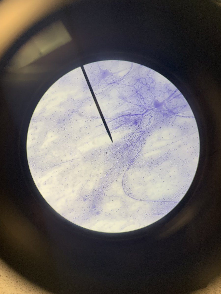 ScienceMadeEas1's tweet photo. Nerve Cell 🔬 https://t.co/K884OI6x2e