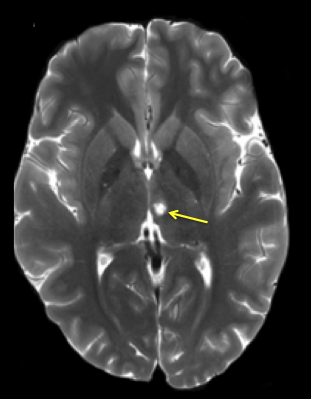 Aaron Boes tweet media
