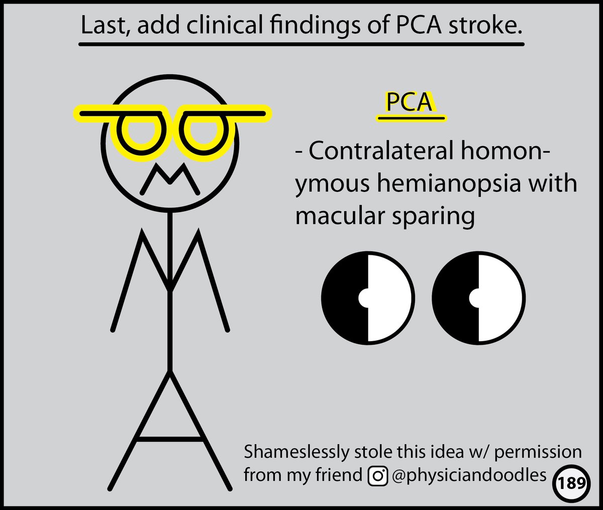 I know a good idea when I steal one. At the end of every chapter of the "How To Read A Head CT" comic, there's a brief drawing lesson to reinforce key concepts. The brilliant EM doc <a href="/PhysicianDoodle/">Doodz</a> came up w/ this memorable way of learning clinical ACA/MCA/PCA stroke findings.