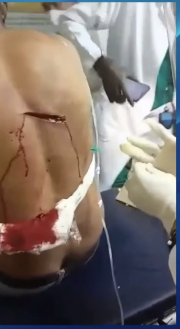 parquevidal's tweet photo. If you are thinking of going to Cuba, keep in mind that Cuba is a dangerous country. Look at this man, they almost killed him for stealing his motorcycle. They could also want to rob you because the criminals assume that you have money. https://t.co/oIVPOMiIDf