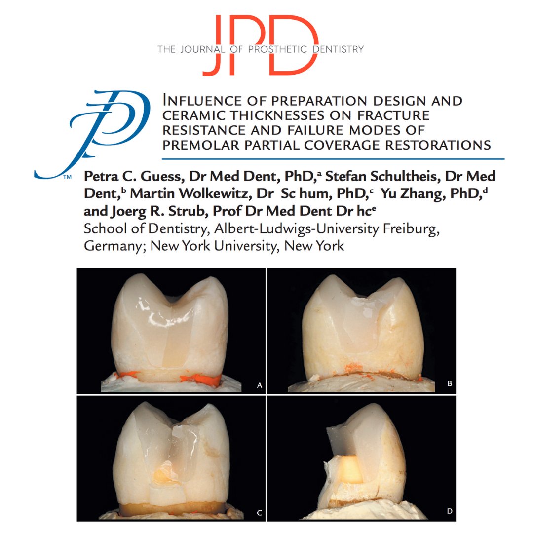 JPDentistry's tweet photo. At the @AProsthoSociety 93rd Annual Meeting, Dr. Petra Guess Gierthmuehlen will discuss "Minimally Invasive Concepts &amp; Digital Dentistry"

Check out her JPD article on fracture &amp; fatigue resistance of #lithiumdisilicate with different preparation designs: https://t.co/Js0FFkelYH https://t.co/7VnBvzoU3v