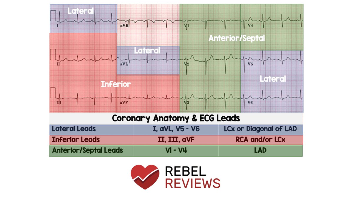 Medical_MD1's tweet photo. Quick Review on 

Basics of EKG 😍👌🏼

. https://t.co/d90T5f16zT