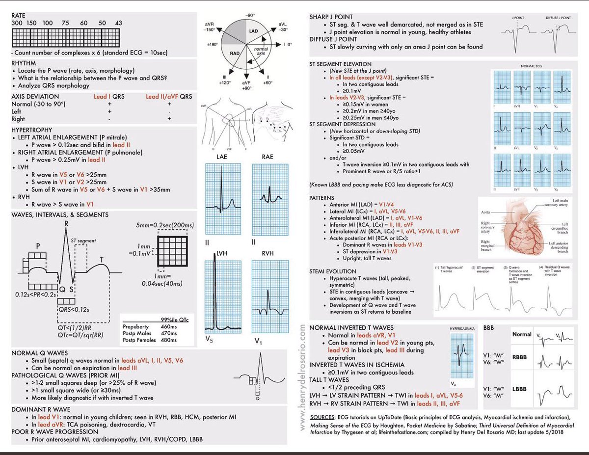 Medical_MD1's tweet photo. Quick Review on 

Basics of EKG 😍👌🏼

. https://t.co/d90T5f16zT