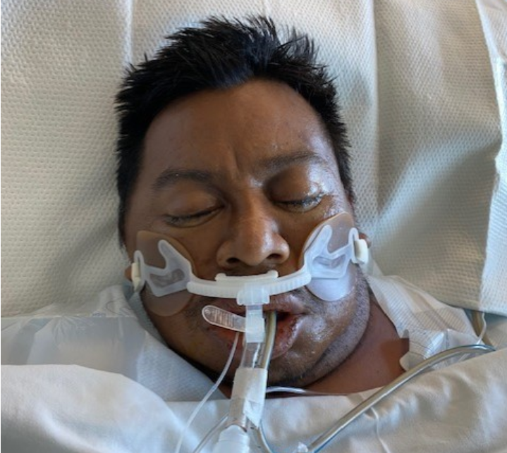 ReporterClaudia's tweet image. .@WeAreLAHealth is asking for help identifying this patient. The department says he was hit by a car on Jan. 20 in Playa del Rey. No ID. Not alert. (424) 306-7718.