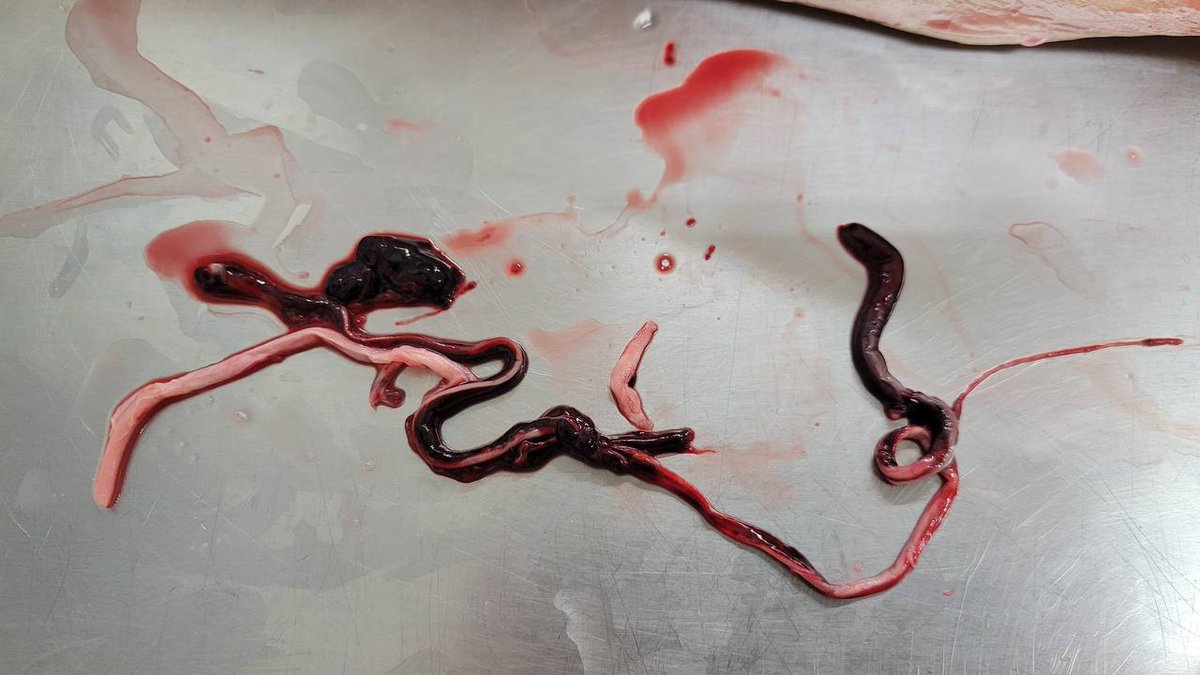 Yo_Ma7510's tweet photo. 🚨Richard Hirschman, directeur de pompes funèbres, a embaumé beaucoup de personnes mortes d'attaques cardiaques/cérébrales.
Il a trouvé leurs veines et artères remplies de caillots non naturels, avec d'étranges matériaux fibreux, remplissant complètement le système vasculaire🤮🤬 https://t.co/wByTvv9JTb