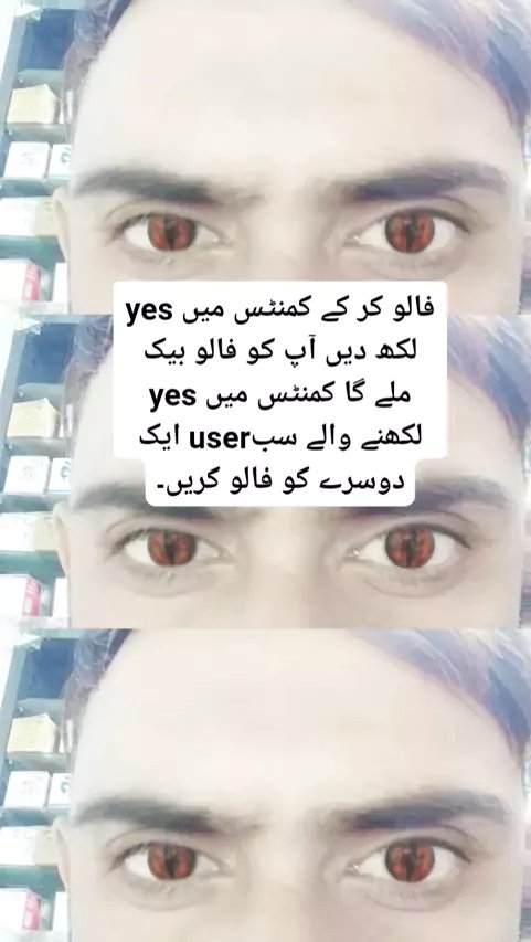 mf_official9's tweet photo. 😊It took me a lot of time to find this video of your choice!
👇👇👇👇👇👇

💌Snack Video is awesome， Come and check it❣️
👇👇👇👇👇👇
https://t.co/gBn94jm4Q8 https://t.co/yDRXLRjaXM https://t.co/mt7jNmJTRe