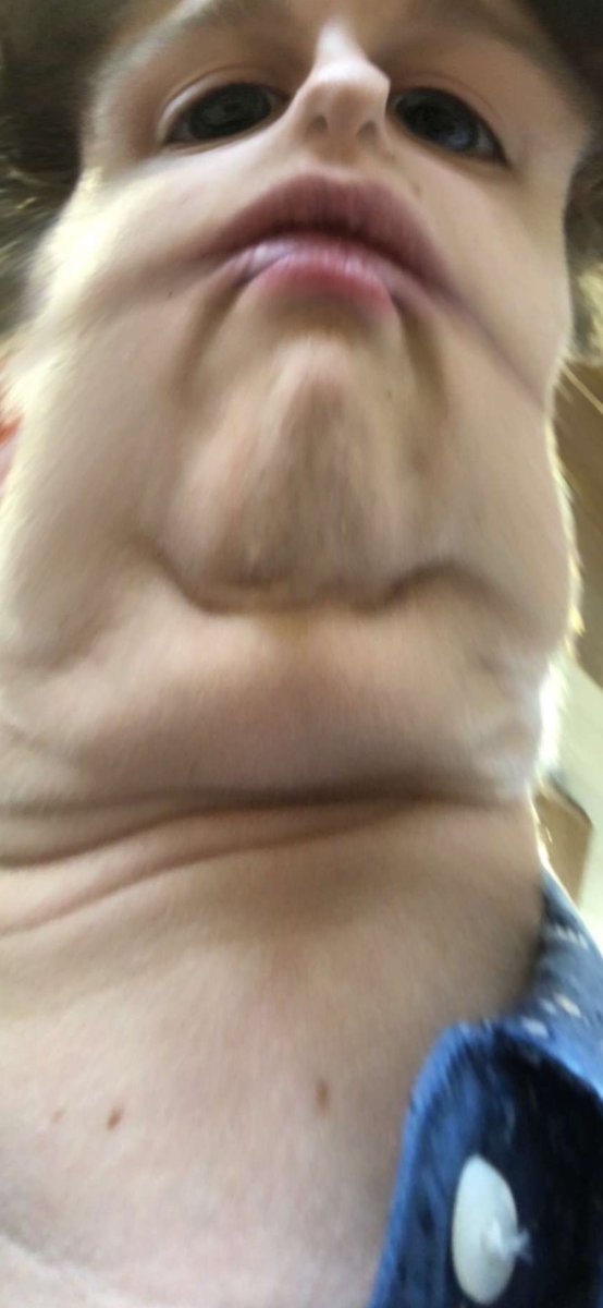 clum_chowder's tweet image. old picture of me