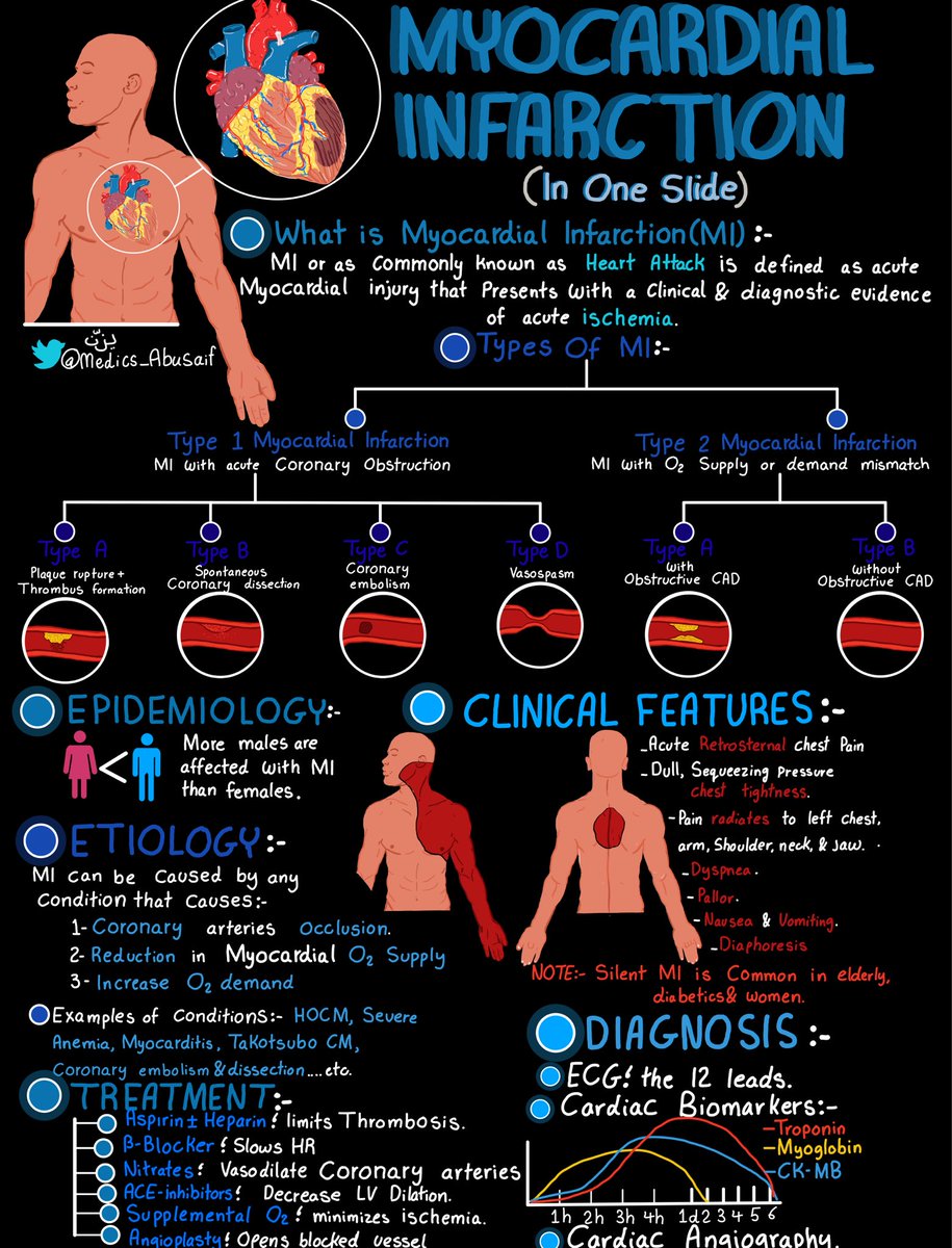 medics_AbuSaif's tweet photo. ملخص شامل عن الـMyocardial Infarction بصفحة 🫀✅ https://t.co/QSpt48kD5j