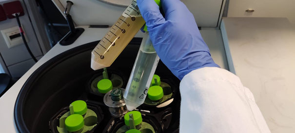 oleoferm's tweet photo. After the feast … #OLEOFERM yeasts are collected for further analysis at @IMDEA_Energia. They better be producing lots and lots of lipids :)
#IMDEAEnergía #Biotechnology #ERAnet #ERA_CoBioTech https://t.co/r0JNgDmsvc