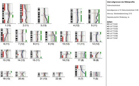 Genetic analysis of single disseminated tumor cells in the lymph nodes and bone marrow of patients with head and neck squamous cell carcinoma

🔗buff.ly/3IFhsn3

📝Karl Christoph Sproll, Lara K. Schorn and team @NickStoecklein @HHU_de 

#LymphNodes #HNSCC #HNCSM