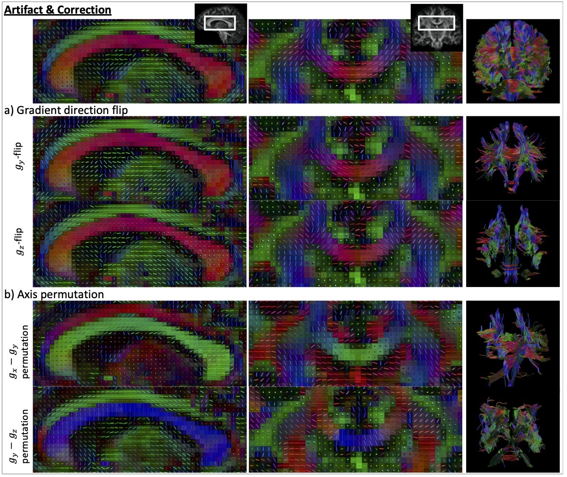 ChantalTax's tweet image. What's new and what's next in #diffusion MRI #preprocessing?
👉 bit.ly/3ABmnmd
Part of the @NeuroImage_EiC special issue Advances in Mapping the #Connectome
@irfanoglu_m @jelle_veraart @garyfallidis @bastiani_matteo