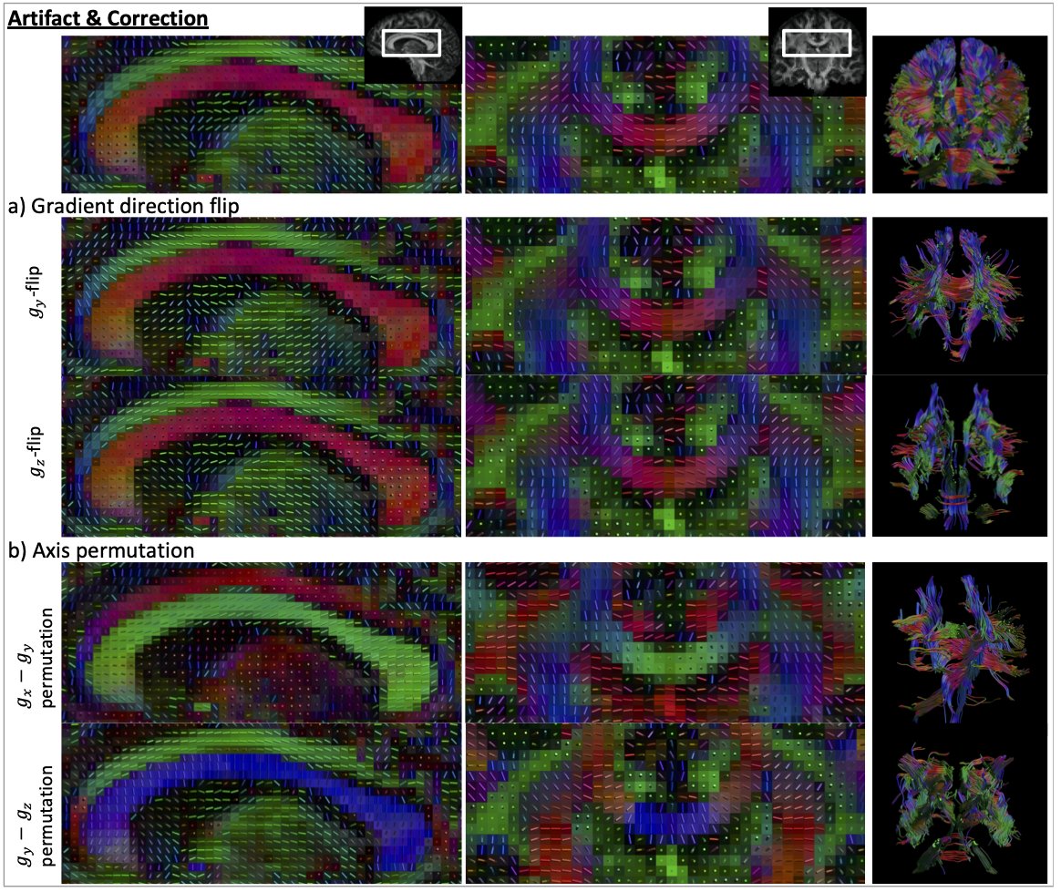 What's new and what's next in #diffusion MRI #preprocessing? 👉 bit.ly/3ABmnmd Part of the @NeuroImage_EiC special issue Advances in Mapping the #Connectome @irfanoglu_m @jelle_veraart @garyfallidis @bastiani_matteo