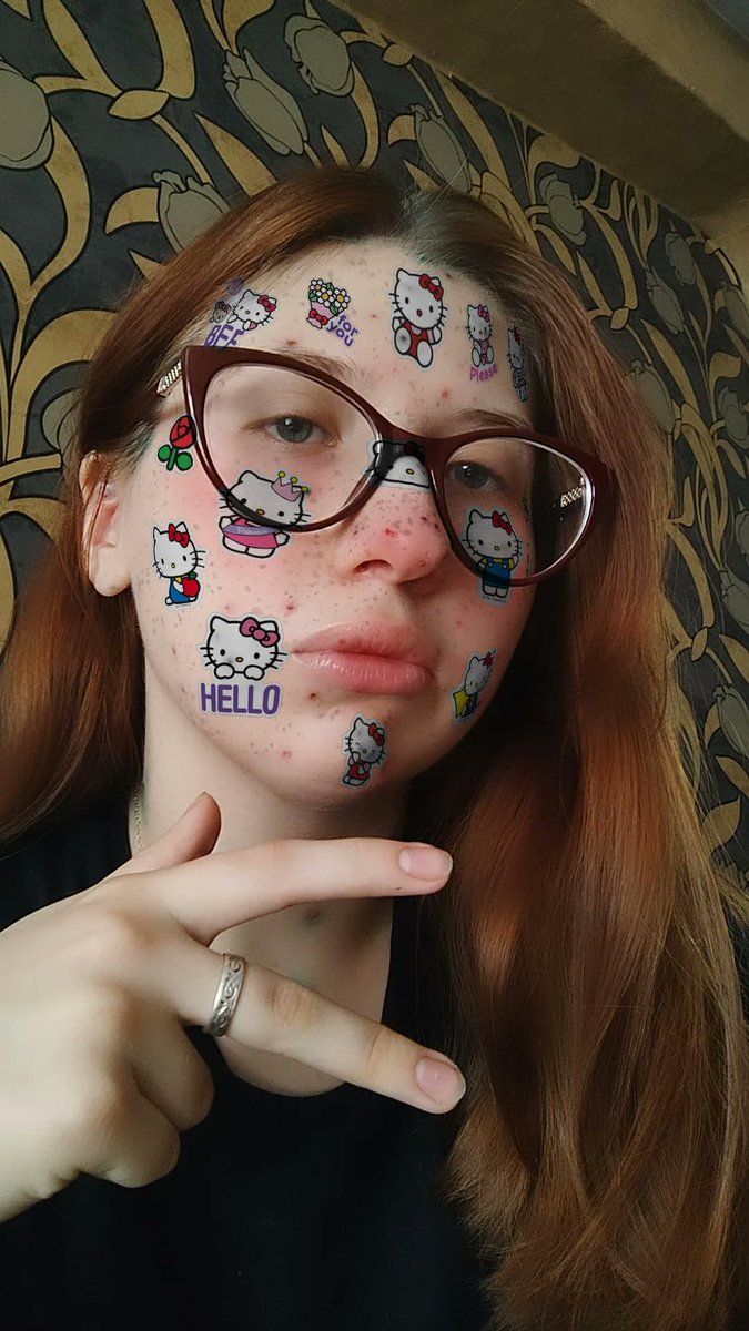 luchisasha's tweet photo. Переболеть ветрянкой в детстве? Неееет!!! Переболеть ветрянкой в 20 лет? О да, это то, что нужно 🤩 https://t.co/eCRMFB9nVW