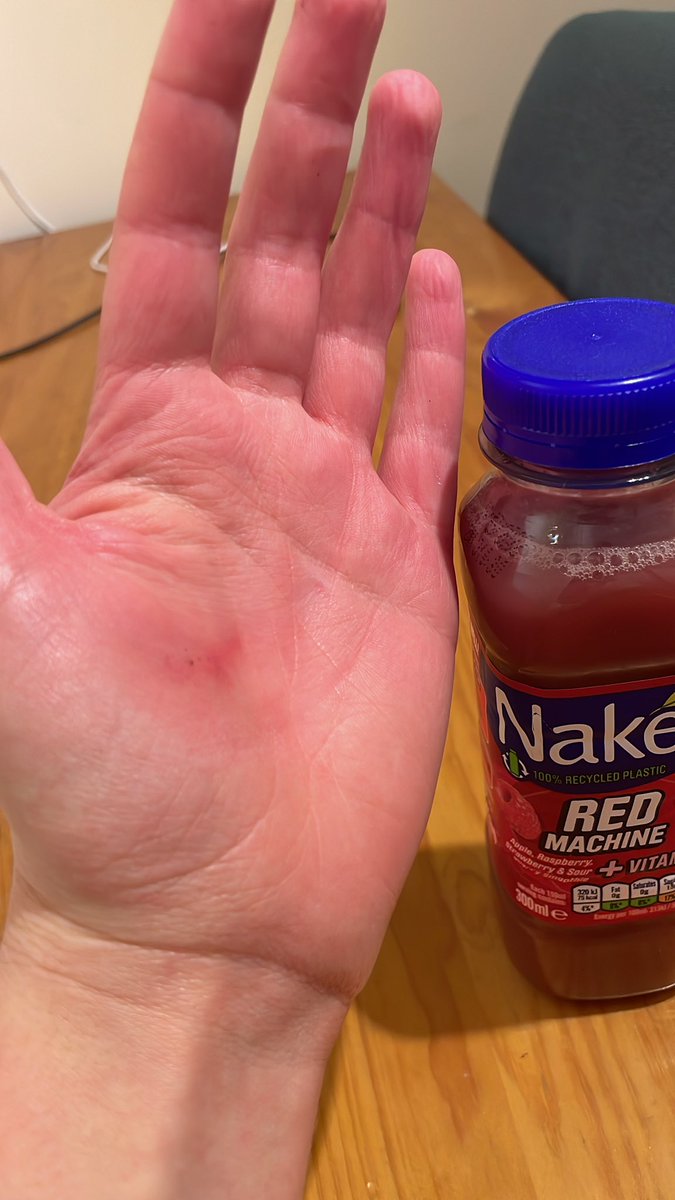 AshleighCattle8's tweet photo. @nakedjuice please can you make your lids easier to open please. I’m really thirsty and can’t open it and nearly cut my hand open trying, thanks xxx https://t.co/0sCSgR6L87