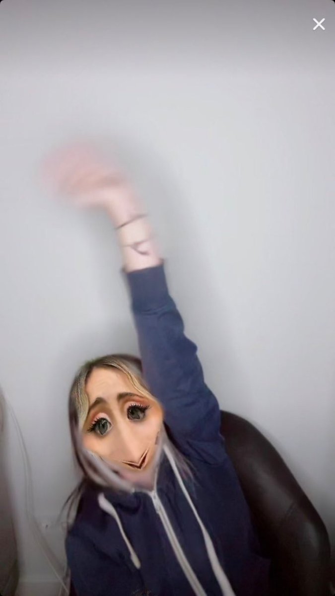 cemresolmazcm's tweet image. Yüzüm domates gibi alırım bi geçmiş olsununuzu