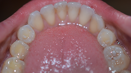 Find out the results that are possible with various orthodontic treatments in our gallery bit.ly/2rPU56c