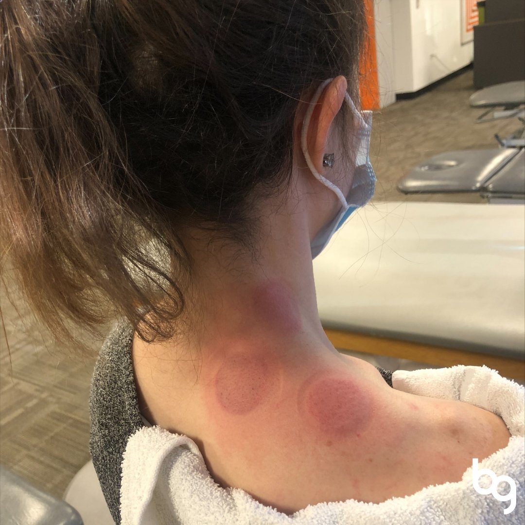 Body Gears Physical Therapy tweet media