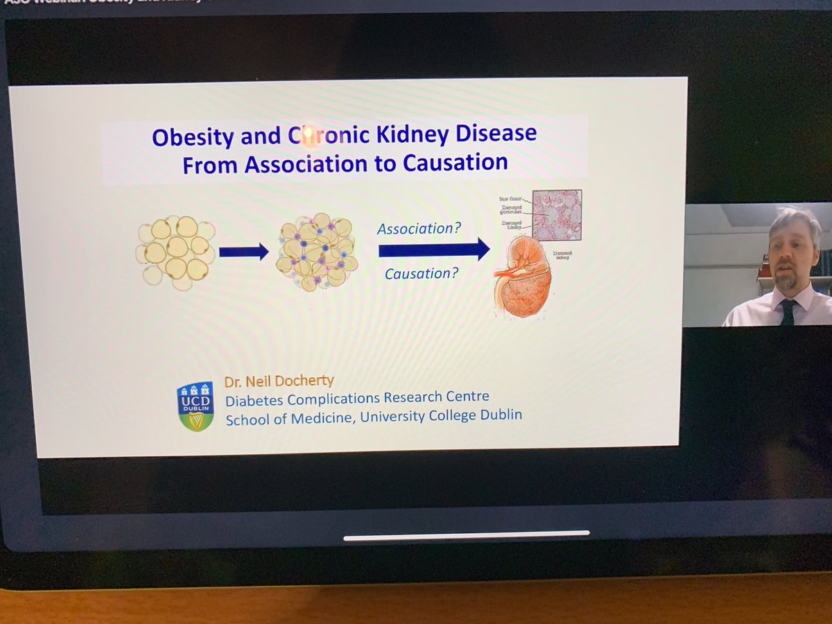 Mpmok's tweet photo. Dr Neil Docherty starting off this important #ASOwebinars on #obesity and #ChronicKidneyDisease https://t.co/VnKqEeEr3u