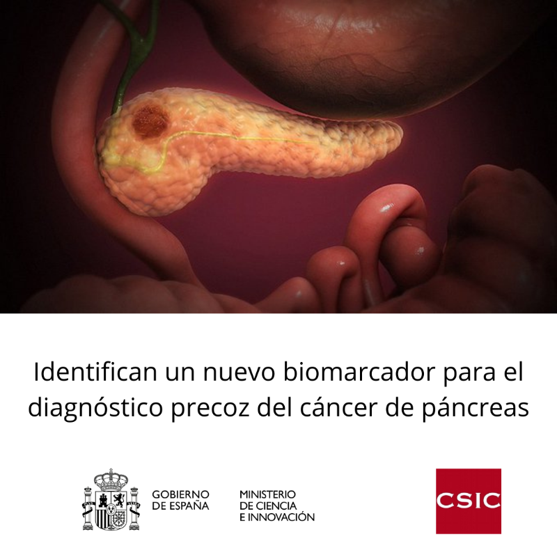CienciaGob's tweet photo. Un estudio coliderado por el @CSIC identifica un nuevo biomarcador de diagnóstico precoz para el cáncer de páncreas.

Los investigadores asocian la presencia de la proteína AXL a la detección de este tipo de tumores, la tercera causa de muerte por cáncer en países desarrollados.