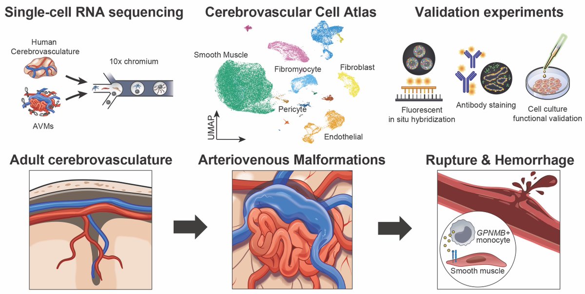 Excited to share our paper in <a href="/ScienceMagazine/">Science Magazine</a> defining the cell composition of the human cerebrovasculature and abnormalities in brain AVMs underlying hemorrhagic stroke for future therapy. <a href="/NeurosurgUCSF/">UCSF Neurosurgery</a> <a href="/UCSF/">UC San Francisco</a> <a href="/LabNowakowski/">Nowakowski_Lab</a> <a href="/BarrowNeuro/">BarrowNeurological</a> <a href="/mtlawton/">Michael T. Lawton, MD</a> <a href="/TAAF/">The Aneurysm and AVM Foundation (TAAF)</a>
bit.ly/3IJXrMo